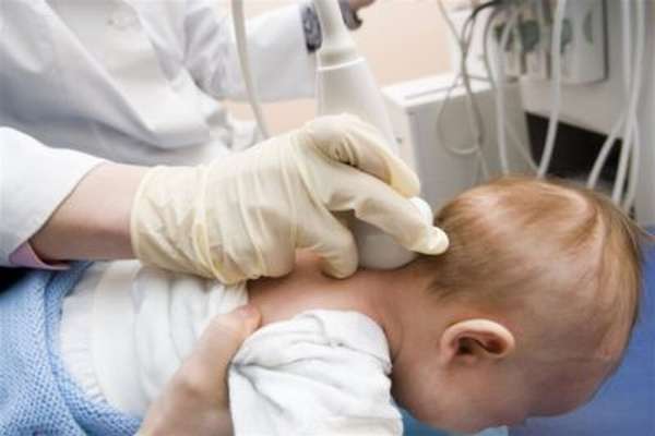 Вывих шейных позвонков у новорожденных симптомы