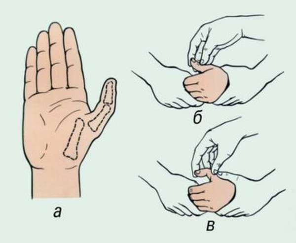 Как оказать первую помощь при вывихе пальца