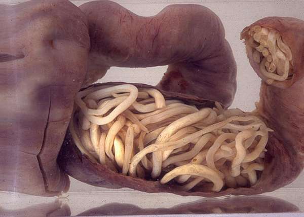 Вы бы съели паразитических червей ради похудения?