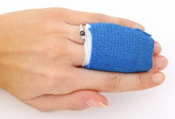 Переломы и трещины пальцев рук