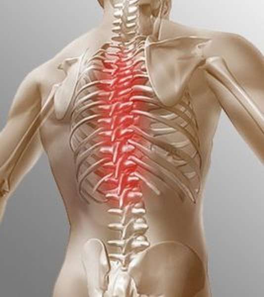 Как лечить ушибы мышц спины