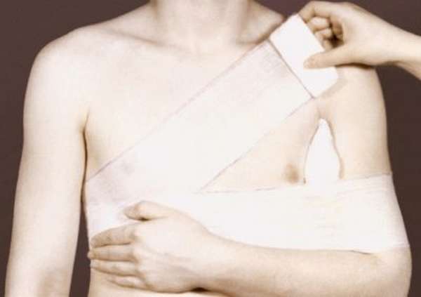Как фиксировать вывих плечевого сустава