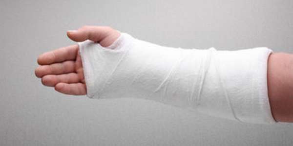 Перелом руки после наложения гипса