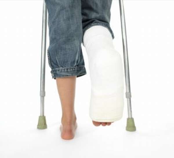 Сколько надо ходить в гипсе при переломе ноги