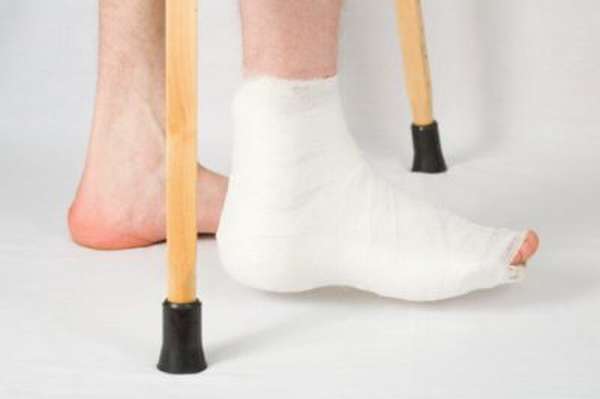 Перелом ноги сколько ходят в гипсе