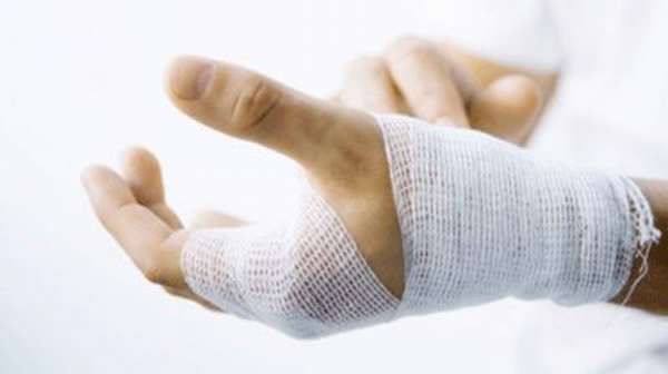 Оказание первой помощи при закрытом переломе руки