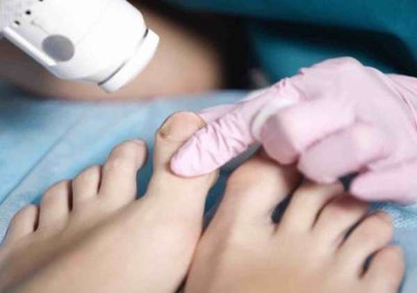 Лечение трещины кости большого пальца ноги