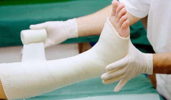 Сколько нужно ходить с гипсом при переломе ноги