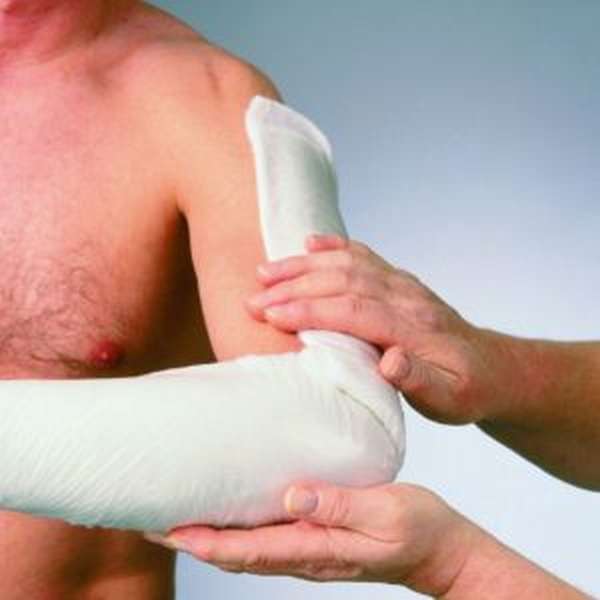 Место типичного перелома у плечевой кости